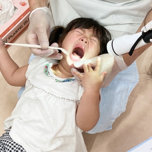 泣きながら大きな口を開けて歯科検診を受ける子ども